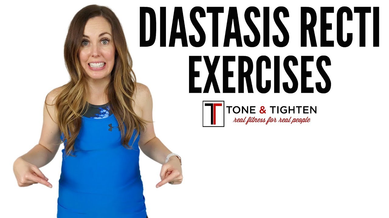 Diastasis Recti Exercises - From a doctor of physical therapy